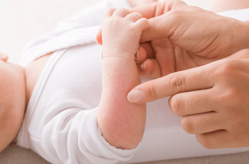 Mẹo chữa mụn sữa ở trẻ sơ sinh